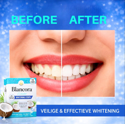 Blancora Exclusive Whitening Strips (7-Day Treatment, 2- Strips per Pack) Safe Strip Technology