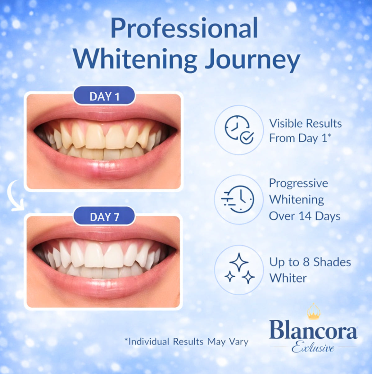 Blancora Exclusive Whitening Strips (7-Day Treatment, 2- Strips per Pack) Safe Strip Technology